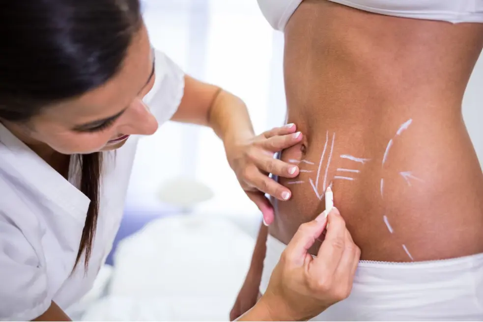 Tummy Tuck Cost and Procedure: What You Need to Know